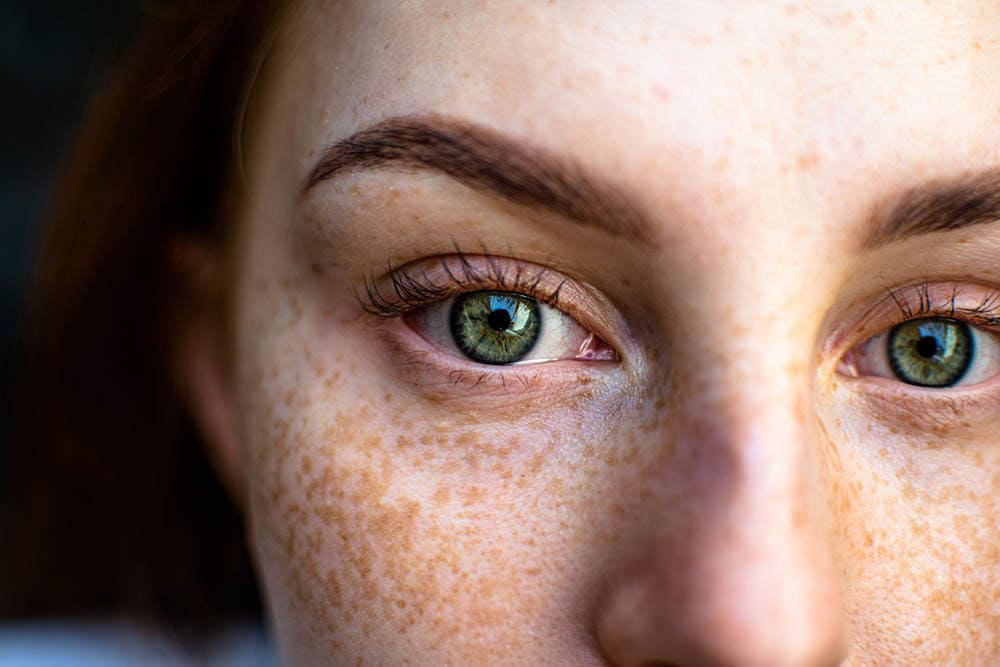 close up woman with freckles on her face