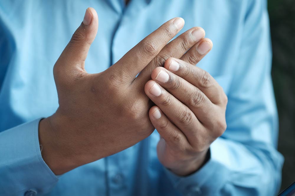 arthritis attack in a man's hand